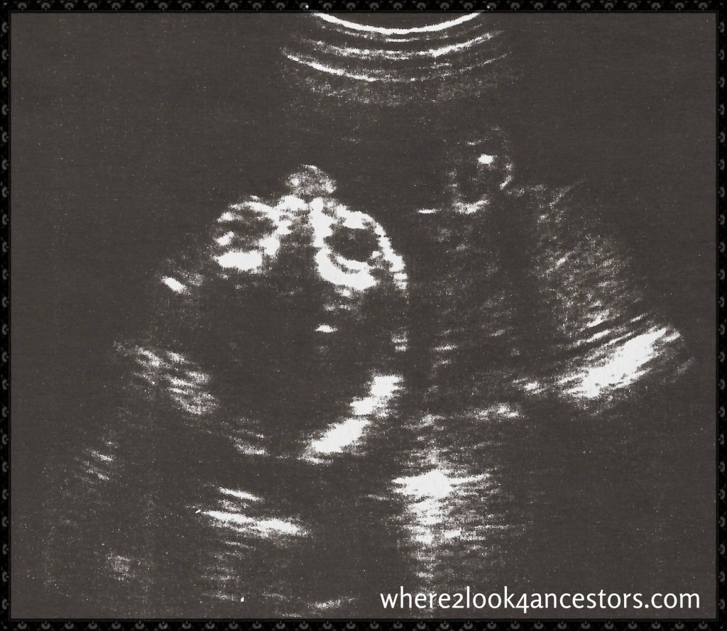1st Photo of 1st Grandchild